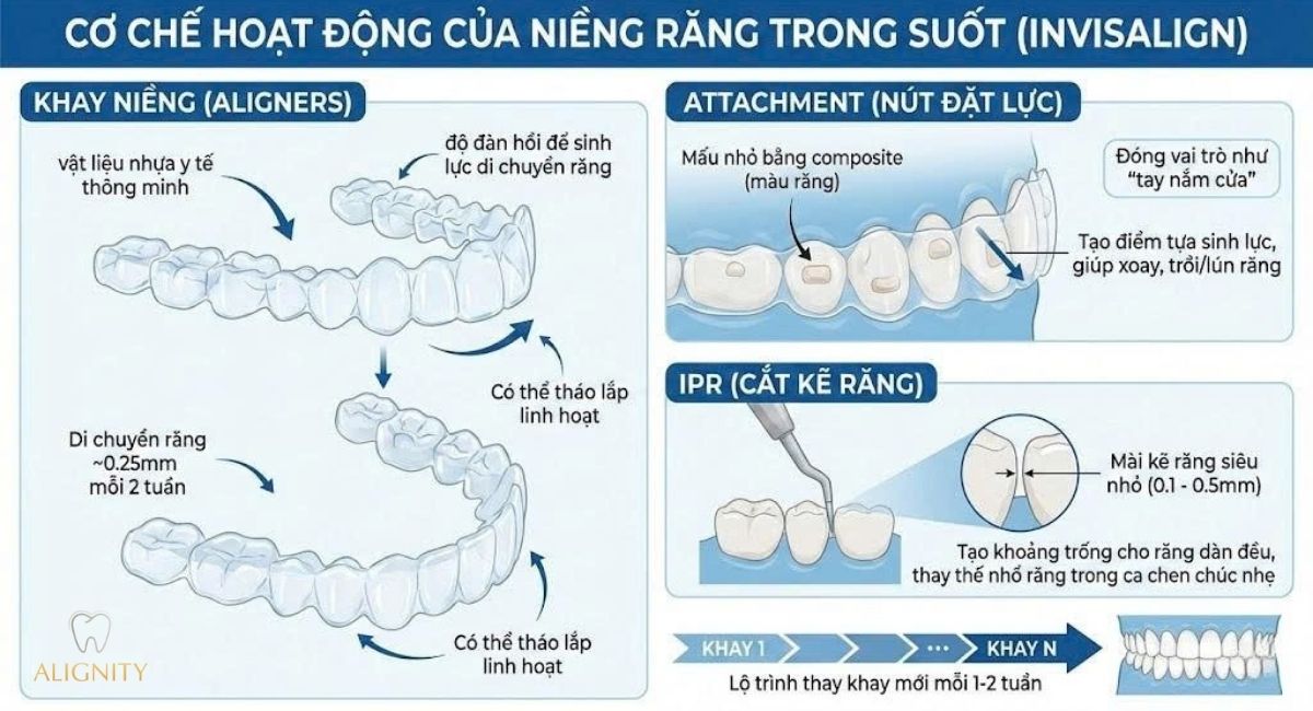 Niềng răng trong suốt là gì? Giá bao nhiêu & Quy trình chuẩn 2026 2 Sơ đồ cơ chế hoạt động của niềng răng trong suốt