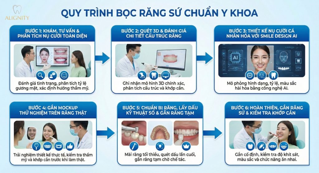 Bọc răng sứ thẩm mỹ – Giải pháp toàn diện cho nụ cười hoàn hảo 3 Minh họa quy trình bọc răng sứ thẩm mỹ tại ALIGNINTY