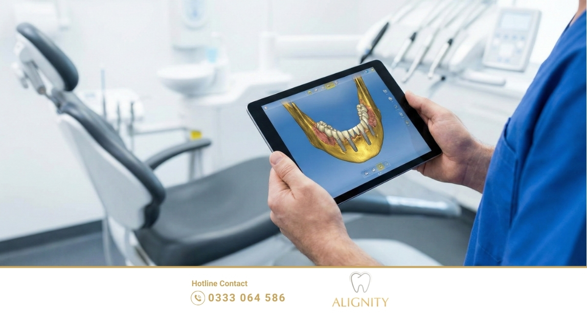 Ảnh đại diện - Implant kỹ thuật số