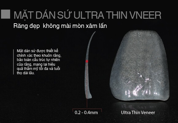 mat dan su ultra thin vneer