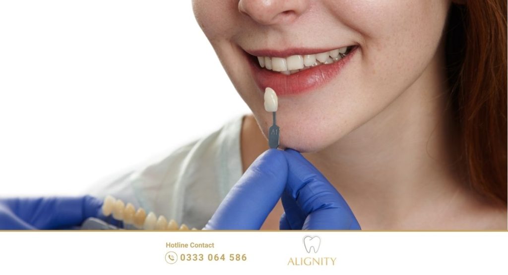 Nha khoa ALIGNITY Cần Thơ: Tiên phong niềng răng trong suốt & implant kỹ thuật số 7 Dịch vụ răng rứ thẩm mỹ tại nha khoa Alignity