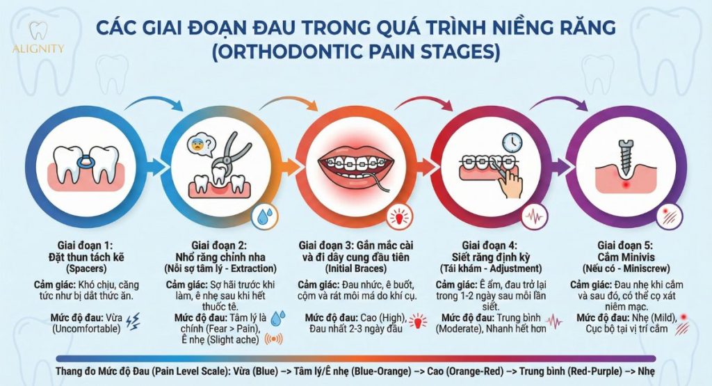 Niềng răng có đau không? Giai đoạn nào đau nhất 2 Infographic 5 giai đoạn đau nhất khi niềng răng: Tách kẽ, nhổ răng, gắn mắc cài, siết răng và cắm Minivis.