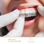 Niềng răng trong suốt Invisalign tháo lắp dễ dàng, ít gây đau đớn và đảm bảo thẩm mỹ.