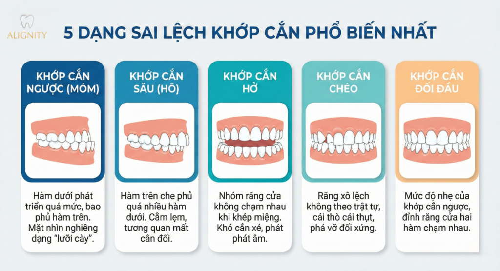 Lệch khớp cắn là gì? Nguyên nhân, tác hại và giải pháp điều trị 4 Các loại lệch khớp cắn phổ biến - Hô, móm, cắn hở, cắn chéo.