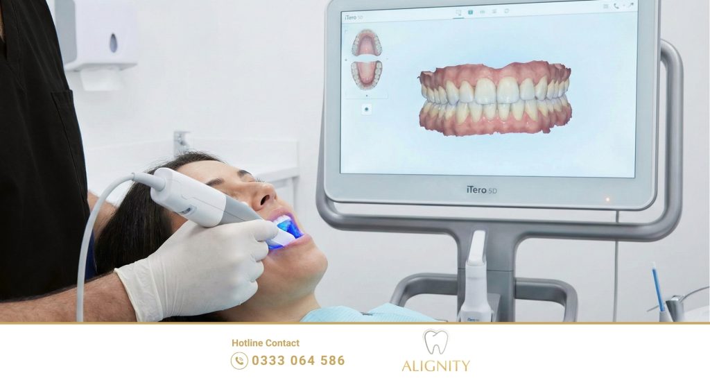 Các dạng sai lệch răng phổ biến: Hô, móm, lệch hàm, chen chúc & cách điều trị 3 Công nghệ Scan 3D iTero 5D tại nha khoa Alignity
