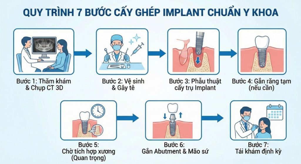 trong rang implant 10