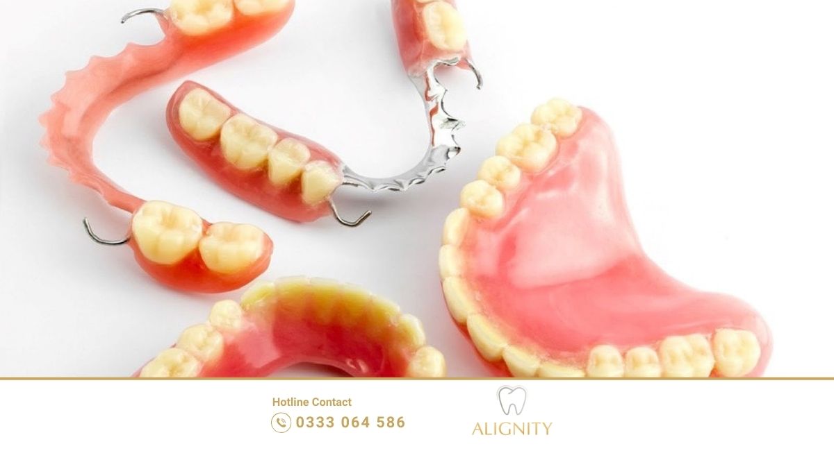 Trồng răng implant - Hàm giả tháo lắm