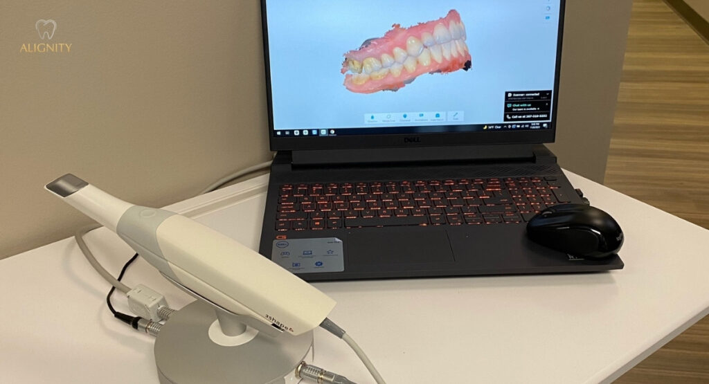 Máy Scan 3Shape Trios lấy dấu răng số cho khách hàng.
