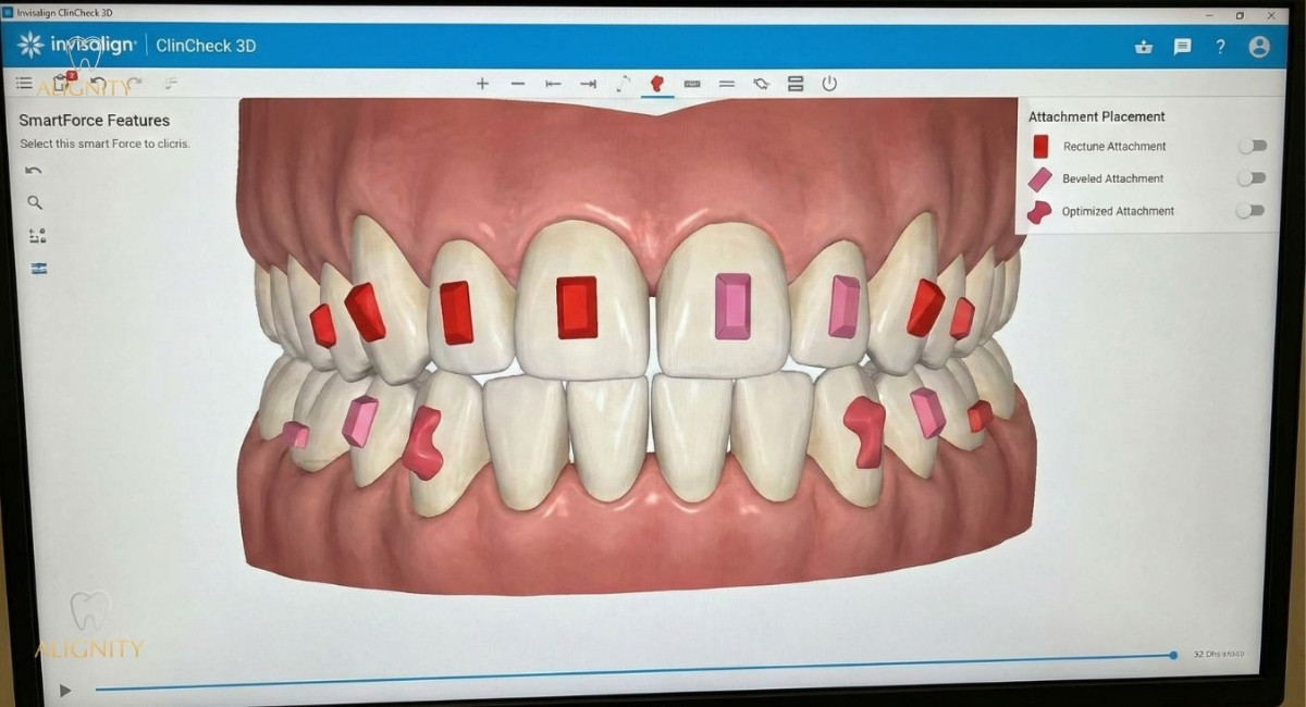 Hình ảnh giao diện 3d Clincheck
