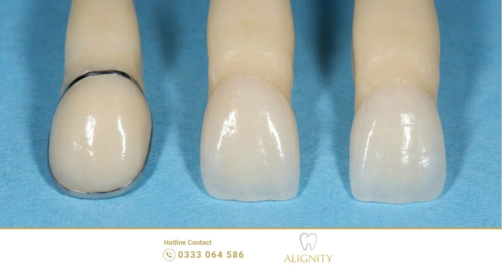 Nhờ khả năng lấy dấu răng chi tiết đến từng góc cạnh, bác sĩ xác định chính xác mức độ sai lệch và các bệnh lý răng miệng liên quan