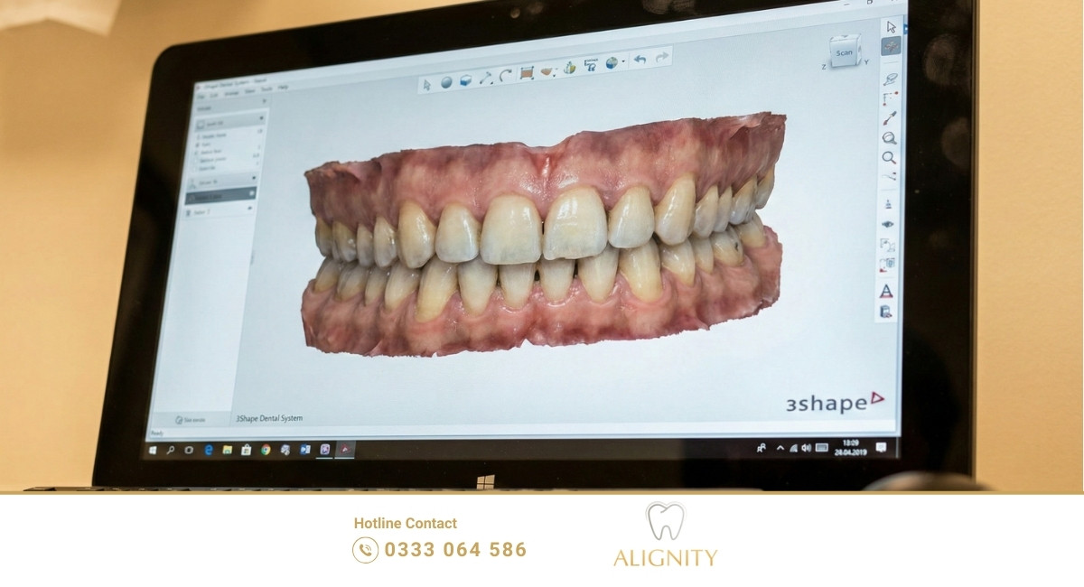 Công nghệ Scan 3D Shape Trios