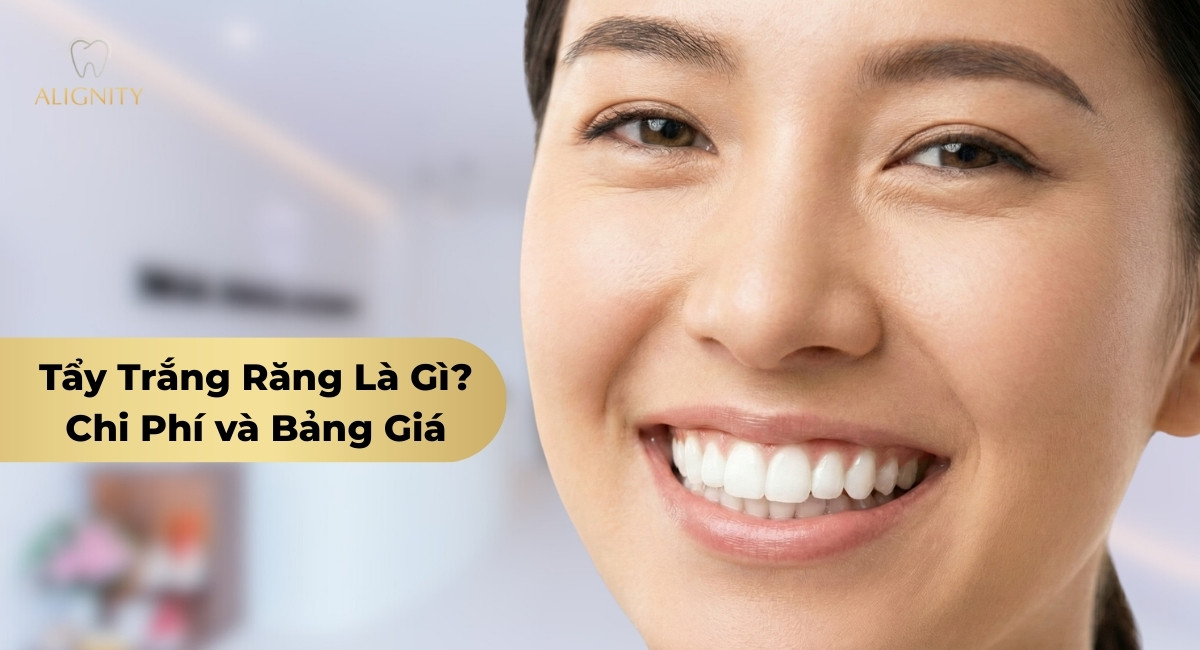 Tẩy trắng răng công nghệ hiện đại mang lại nụ cười trắng sáng tại Nha khoa ALIGNITY.
