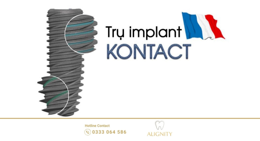 Trụ implant kontact: tìm hiểu xuất xứ, ưu điểm và bảng giá 2026 1 Trụ implant kontact là dòng trụ chân răng nhân tạo cao cấp, được nghiên cứu và phát triển tại Pháp – quốc gia có nền y tế và nha khoa hiện đại bậc nhất châu Âu