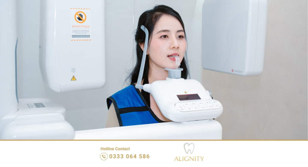Những điều cần lưu ý khi chụp phim Conebeam CT