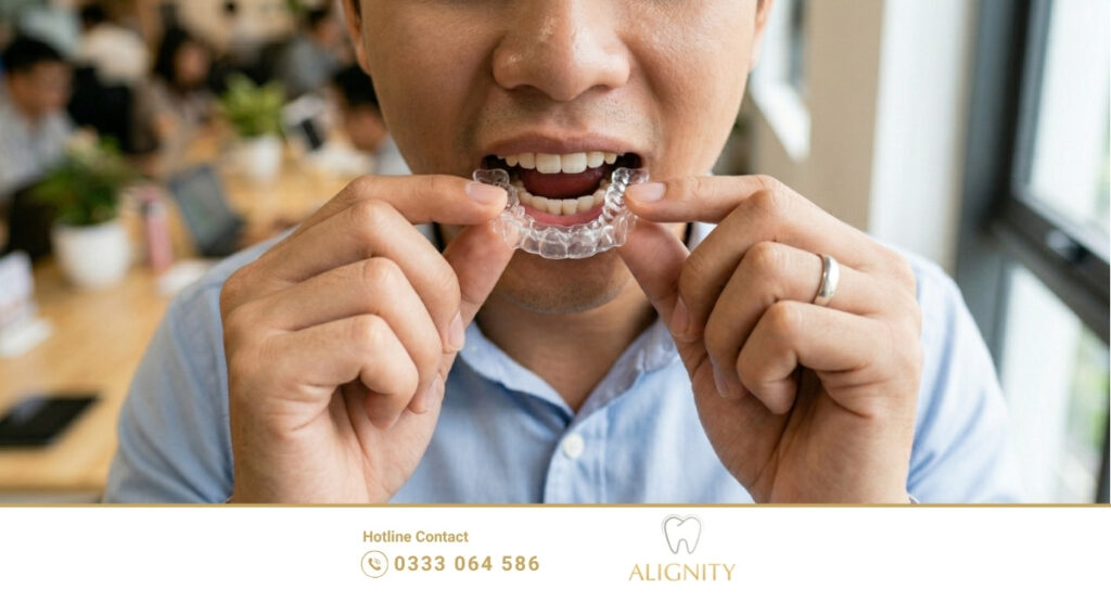 Cận cảnh chất liệu và độ mỏng của khay niềng trong suốt ALIGNITY