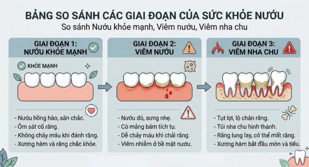 Viêm nha chu tiến triển theo từng giai đoạn 